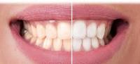 Woodleigh Waters Dental Surgery - Dentist Pakenham image 1